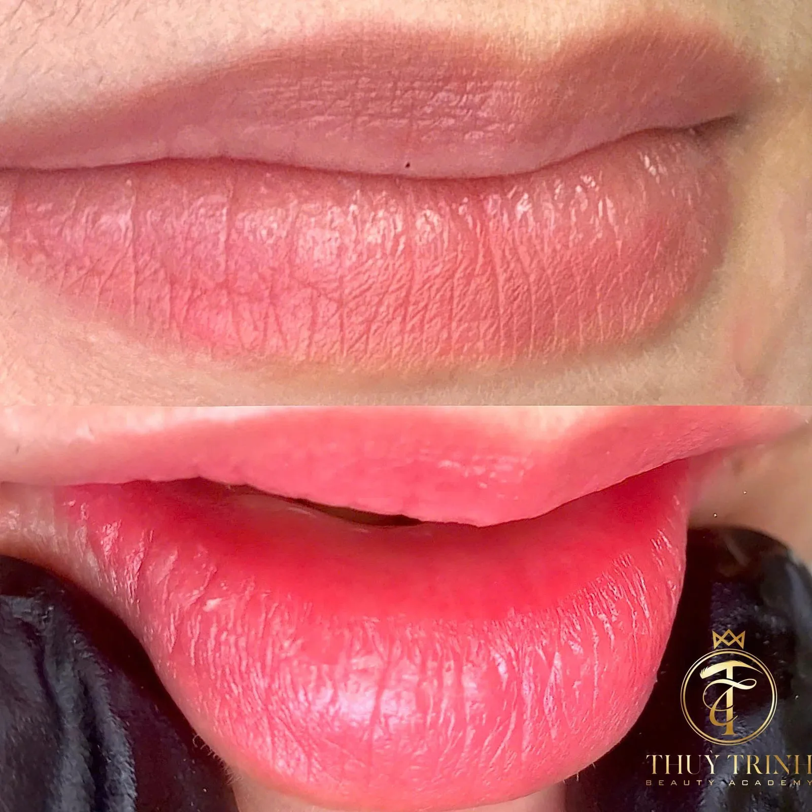 Trước & Sau phun môi Collagen phục hồi nền môi nhợt nhạt, khô rãnh