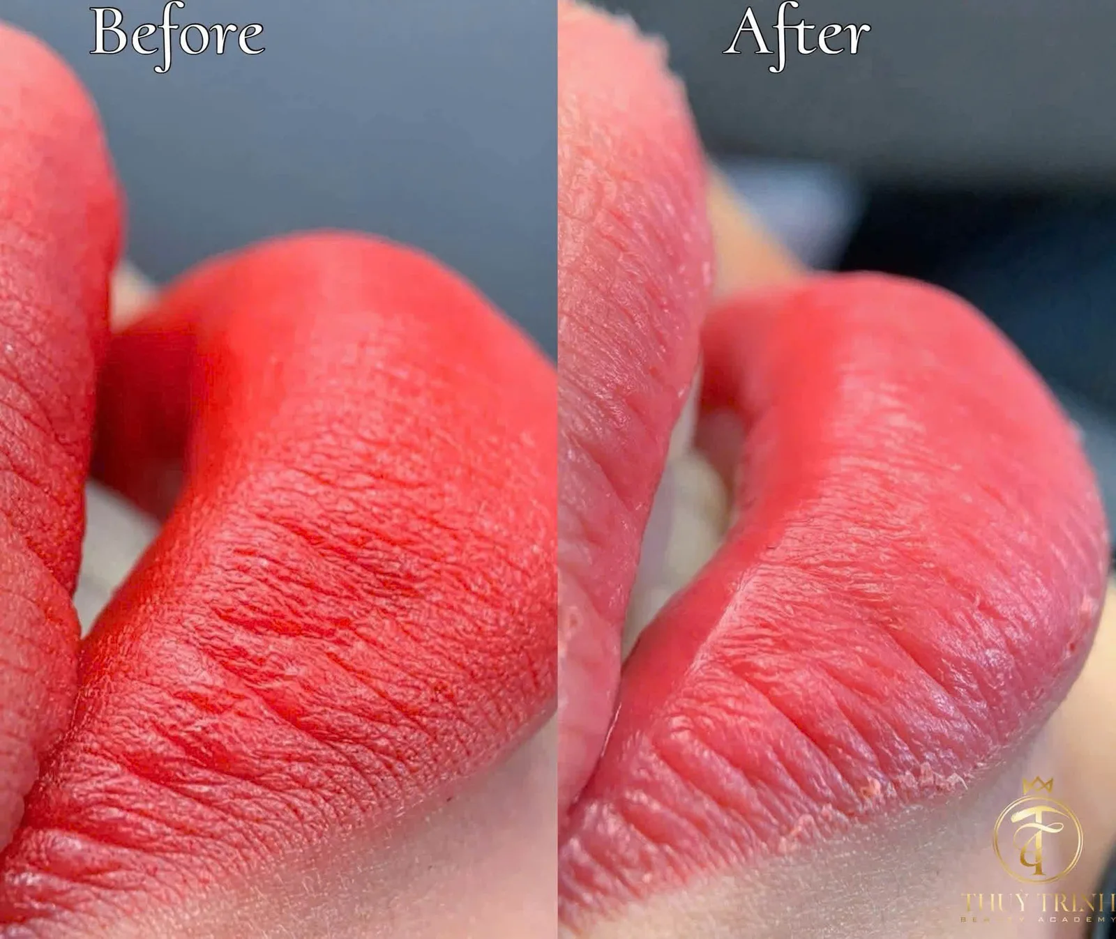 So sánh Before & After khử thâm và phủ màu môi sinh học siêu mịn
