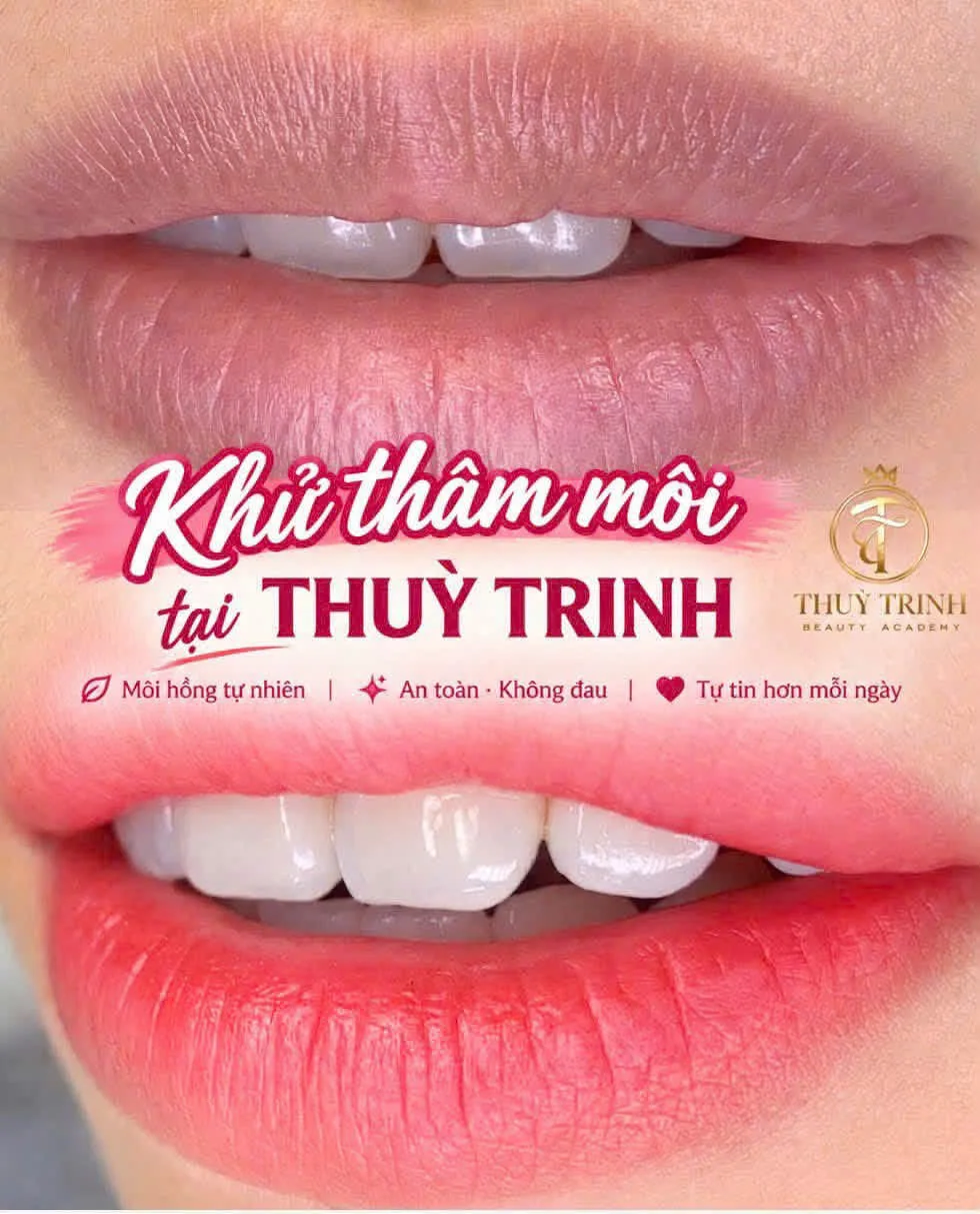 Khử Thâm Môi tại Thuỳ Trinh – Môi hồng tự nhiên, êm ái nhẹ nhàng