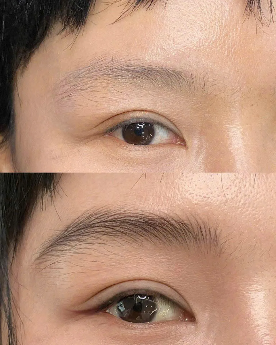 Trước & Sau điêu khắc chân mày Nam tự nhiên – Tôn thần thái nam tính, lịch lãm