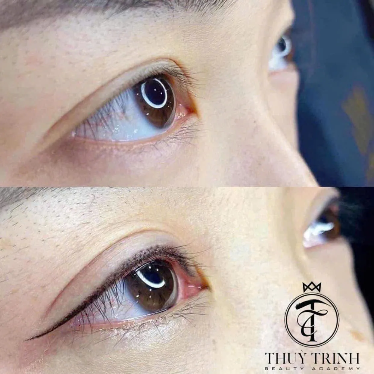 Trước & Sau phun mí mở tròng kết hợp đá đuôi nhẹ nhàng, mắt to tròn có hồn hơn