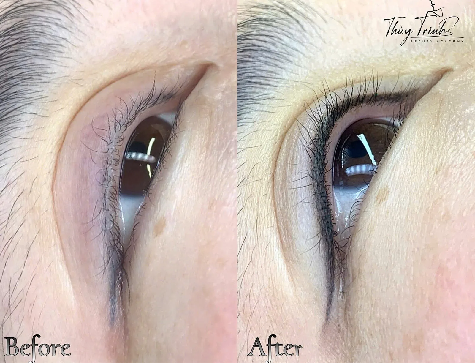 So sánh Before & After phun mí mở tròng – Lấp đầy khoảng trống chân mi