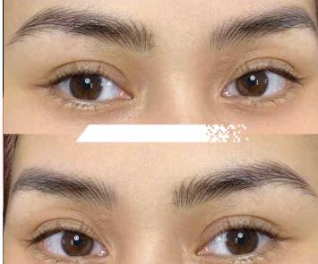 Flexbrows Pro (Sợi Spine Châu Á)