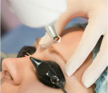 Laser 3 – Liệu Trình Xóa Sạch Không Giới Hạn