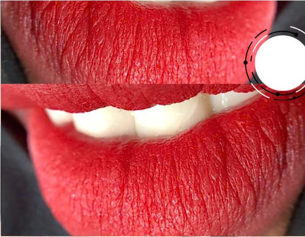 Phun Môi Phong Thủy Là Gì? Ý Nghĩa Dáng Môi Phú Quý