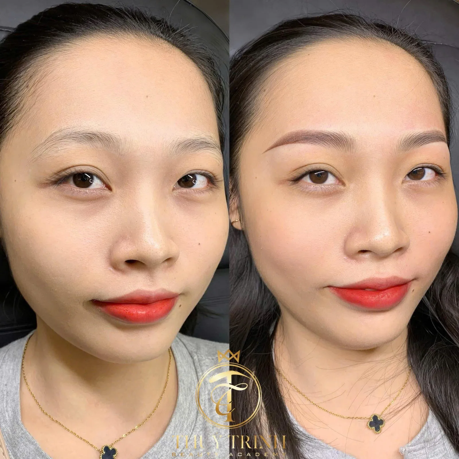 So sánh trước và sau khi điêu khắc chân mày sợi Flexbrows tại Master Thuỳ Trinh