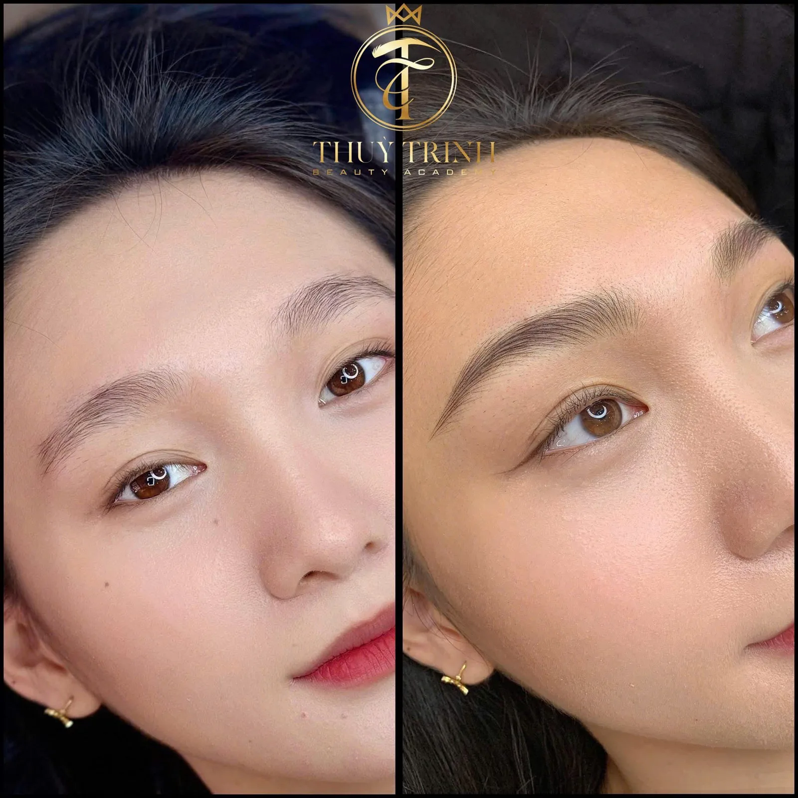 Chị Minh Thư chụp ảnh lưu niệm cùng Quán quân Master Thuỳ Trinh sau liệu trình thành công